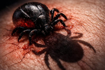 Krónikus Lyme-kór - terjedése, késői felismerése/diagnózis, tünetei, kezelése (Dr Richard Horowitz MSIDS-protokoll), társfertőzések