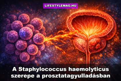 Staphylococcus haemolyticus baktérium okozta fertőzés szerepe a krónikus prosztatagyulladásban (prosztatitisz, CPPS)