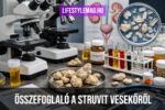 Ábra: Struvit kő, kövek nefrológus kutatói asztalán (Összefoglaló cikk a struvit vesekő kialakulásának okai, jellemzői, tünetei, kezelése, megelőzése, diétája témában.)