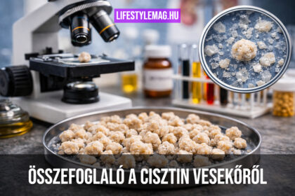 Cisztin kövek laboratóriumban – kis cisztin vesekövek mikroszkóp alatt