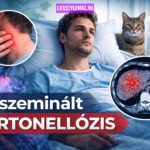 12 disszeminált bartonellózis (Bartonella-fertőzés) beteg esete