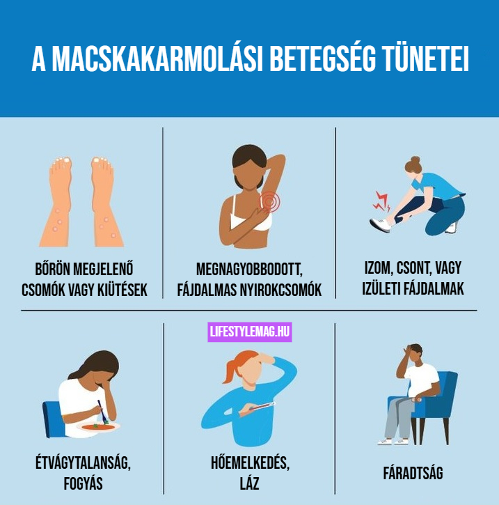 Ábra: A macskakarmolási betegség tünetei - Bőrön megjelenő csomók vagy kiütések; megnagyobbodott és fájdalmas nyirokcsomók; izomfájdalmak, csontfájdalmak, vagy izületi fájdalmak; étvágytalanság, fogyás; hőemelkedés vagy láz; fáradtság.