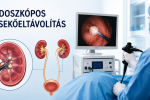 Endoszkópos vesekőeltávolítás, vesekőműtét - menete, előnyei, szövődményei (vesefertőzés, vesemedence-gyulladás, vérmérgezés)