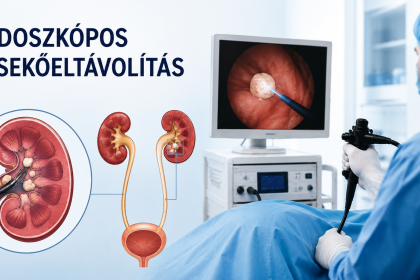 Endoszkópos vesekőeltávolítás, vesekőműtét - menete, előnyei, szövődményei (vesefertőzés, vesemedence-gyulladás, vérmérgezés)